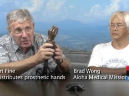 Art-Fine-and-Brad-Wong-On-Distributing-Prosthetic-Hands-attachment