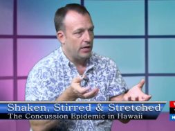 The-Concussion-Epidemic-You-Cant-Ice-Your-Brain-with-Robert-Sloan-attachment